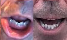 Dental / Teeth Profile Comparison
